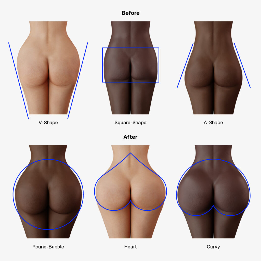 Bum shapes